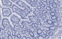 Anti-LONP1 Antibody, clone 1I18, ZooMAb� Rabbit Monoclonal 