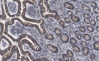Anti-LONP1 Antibody, clone 1I18, ZooMAb� Rabbit Monoclonal 