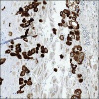 Anti-LOXL3 antibody produced in rabbit HPA035281-100UL