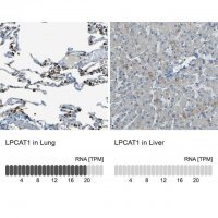 Anti-LPCAT1 antibody produced in rabbit 