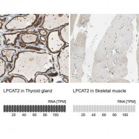 Anti-LPCAT2 antibody produced in rabbit 