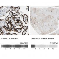 Anti-LRPAP1 antibody produced in rabbit 