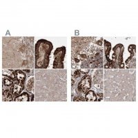 Anti-LRPPRC antibody produced in rabbit 