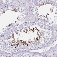 Anti-LRRC36 antibody produced in rabbit 
