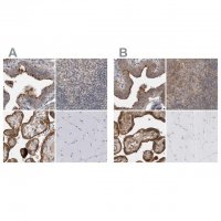 Anti-LRRC45 antibody produced in rabbit 