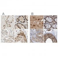 Anti-LRRC47 antibody produced in rabbit HPA008512-100UL