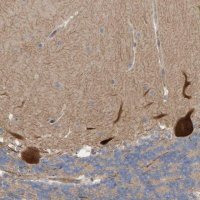 Anti-LRSAM1 antibody produced in rabbit