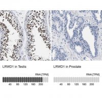 Anti-LRWD1 antibody produced in rabbit 