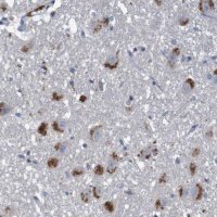 Anti-LTA antibody produced in rabbit
