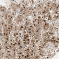 Anti-LTA4H antibody produced in rabbit 