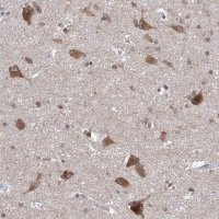 Anti-LURAP1 antibody produced in rabbit 