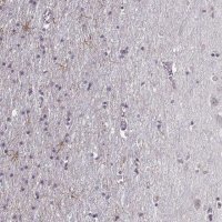 Anti-LUZP2 antibody produced in rabbit
