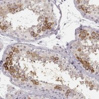 Anti-LY6K antibody produced in rabbit 