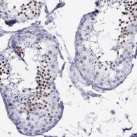 Anti-LYAR antibody produced in rabbit 