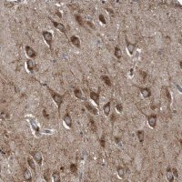 Anti-LYRM4 antibody produced in rabbit 