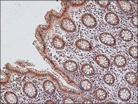 Anti-Lysyl Oxidase (C-terminal) antibody produced in rabbit 