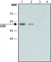 Anti-Lysyl Oxidase antibody produced in rabbit 