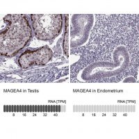 Anti-MAGEA4 antibody produced in rabbit 