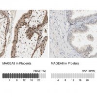 Anti-MAGEA8 antibody produced in rabbit 
