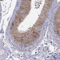 Anti-MAGEB4 antibody produced in rabbit