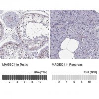 Anti-MAGEC1 antibody produced in rabbit 