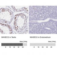 Anti-MAGEC2 antibody produced in rabbit 