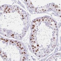 Anti-MAGEC2 antibody produced in rabbit 