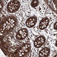 Anti-MAGED2 antibody produced in rabbit 