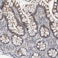 Anti-MAGEE2 antibody produced in rabbit 