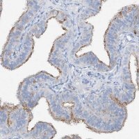 Anti-MAGI1 antibody produced in rabbit 