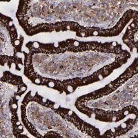 Anti-MAOB antibody produced in rabbit HPA002328-100UL