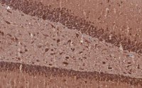 Anti-MAP2 Antibody, clone 3C19, ZooMAb® Rabbit Monoclonal
