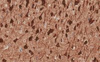 Anti-MAP2 Antibody, clone 3C19, ZooMAb® Rabbit Monoclonal