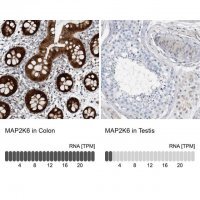 Anti-MAP2K6 antibody produced in rabbit 