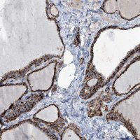 Anti-MARC1 antibody produced in rabbit 