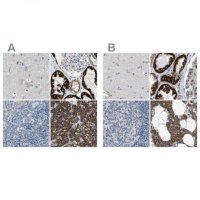 Anti-MARC2 antibody produced in rabbit