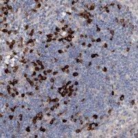 Anti-MASTL antibody produced in rabbit 