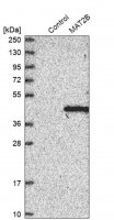 Anti-MAT2B antibody produced in rabbit HPA037721-100UL