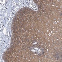 Anti-MBLAC2 antibody produced in rabbit 