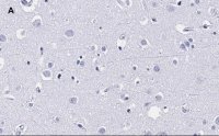 Anti-MBP Antibody, clone 2N6 , ZooMAb� Rabbit Monoclonal 