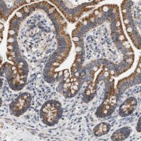Anti-MCU antibody produced in rabbit