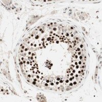 ANTI-MDC1 antibody produced in rabbit 