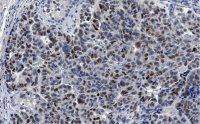 Anti-MDM2 Antibody, clone IF2 ZooMAb� Mouse Monoclonal 