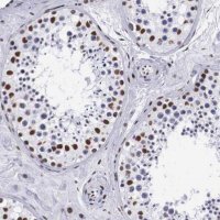 Anti-MECP2 antibody produced in rabbit 