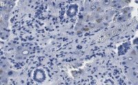 Anti-MeCP2 Antibody, clone 1L20 ZooMAb� Rabbit Monoclonal 