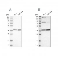 Anti-MECR antibody produced in rabbit HPA028740-100UL