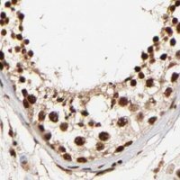 Anti-MED12 antibody produced in rabbit 
