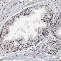 Anti-MED27 antibody produced in rabbit HPA007002-100UL