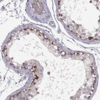 Anti-MEIOC antibody produced in rabbit 