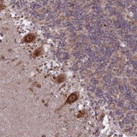Anti-MEOX1 antibody produced in rabbit